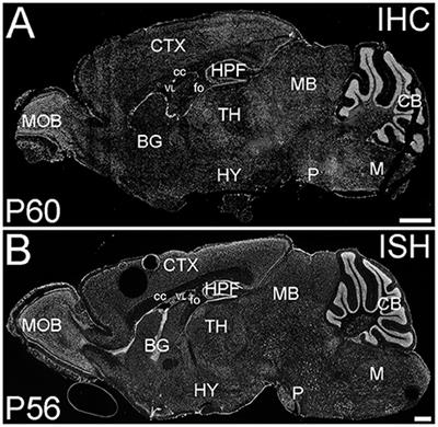 Distribution of ELOVL4 in the Developing and Adult Mouse Brain